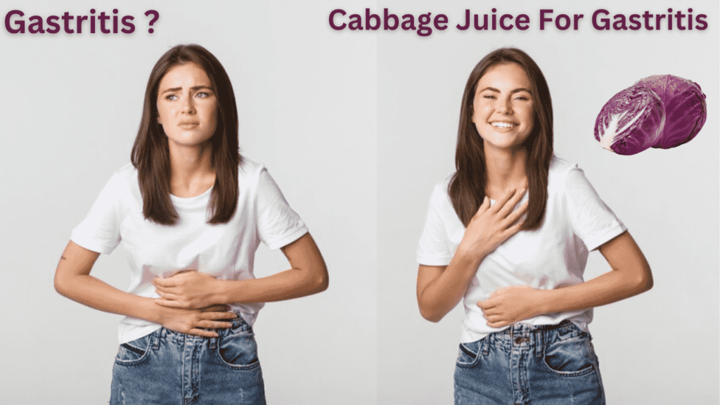 Benefits of Cabbage Juice for Gastritis